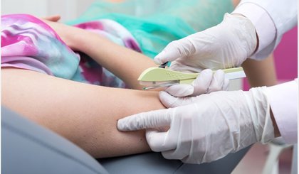 Sesapi distribui 10 mil implantes contraceptivos aos municípios piauienses. (Foto: Reprodução)
