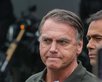 PGR autoriza Jair Bolsonaro a realizar cirurgia no ombro. (Foto: Fabio Rodrigues-Pozzebom/ Agência Brasil